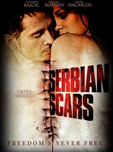 Serbian Scars