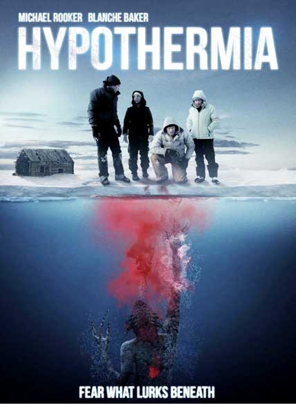 Hypothermia