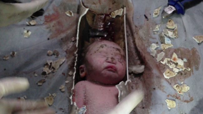 China: Newborn Rescued From Sewer Pipe