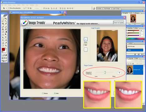 Pearly Whites 2.0.3 - Instant Teeth Whithener