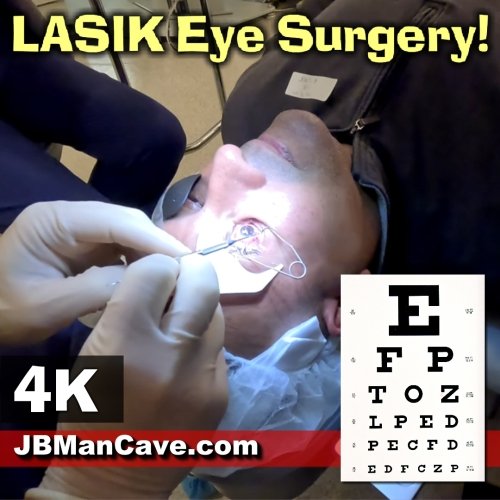 LASIK Eye Surgery Tips