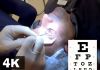 Top  LASIK Eye Surgery Tips